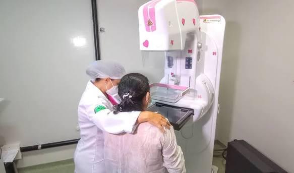 Fortaleza oferece 500 exames gratuitos de mamografia; veja quem pode participar