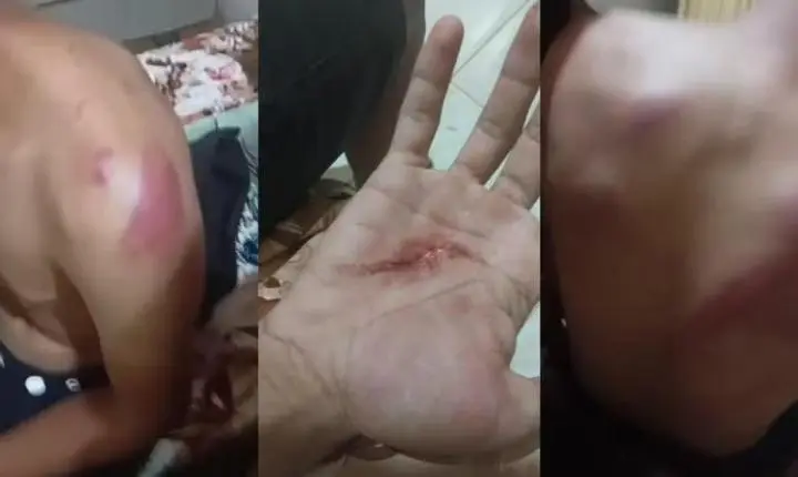 Família denuncia que policiais torturaram jovem com faca, marteladas e saco na cabeça no Ceará
